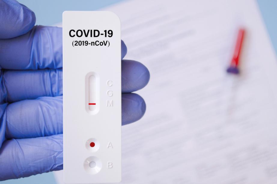 Un test antigénique pour la Covid-19 Un test antigénique pour la Covid-19